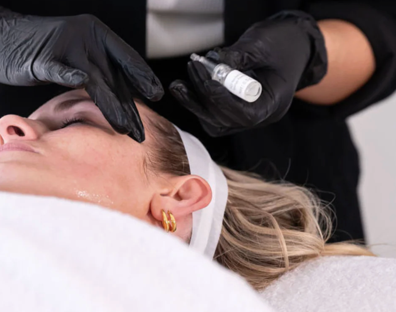 What Makes an SQT Facial Different from Traditional Microneedling?