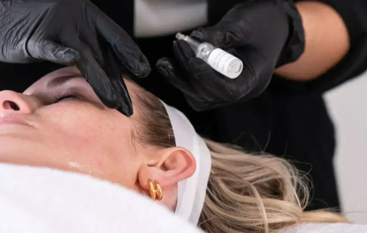 Top Facial Rejuvenation: SQT Bio Microneedling Sydney